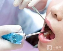 清潔牙齒對(duì)牙齒的好處是什么？洗牙后如何刷牙？