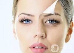 消除法令紋的小妙招有哪些?吃什么去皺?