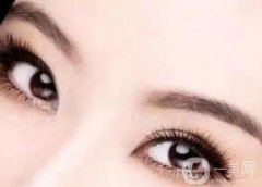 割雙眼皮需要注意什么？割雙眼皮有風(fēng)險(xiǎn)嗎？