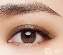 什么是全切雙眼皮？全切雙眼皮是如何恢復(fù)的？