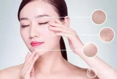 光子嫩膚在哪里可以做？美容院可以做光子嫩膚嗎？