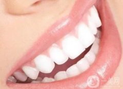 冷光美白牙齒好嗎？術(shù)后護(hù)理？