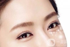 去做眼袋去除手術(shù)后應(yīng)該注意什么?