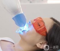 如何護(hù)理冷光美白牙齒？冷光美白牙齒能持續(xù)多久？