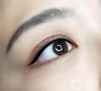 如何護(hù)理美瞳線？埋線雙眼皮手術(shù)后能做美瞳線嗎？
