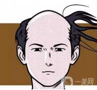 男性脫發(fā)怎么辦?脫發(fā)真的沒(méi)救了嗎?