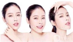 頰脂墊切除方法原來是在口腔內(nèi)展開的?