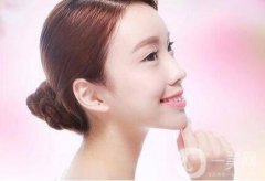 嬰兒肥的臉，是選擇抽脂還是去頰脂墊呢?