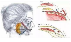 去頰脂墊手術(shù)有風(fēng)險嗎?會有凹痕嗎?