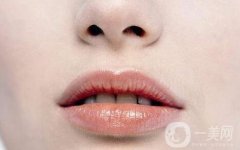 脫唇毛方法有哪些?果如何?唇毛去除后需要注意什么?