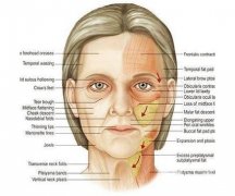人為什么會長腮呢?什么原因?qū)е掳l(fā)腮?發(fā)腮后有沒有補(bǔ)救的方法?