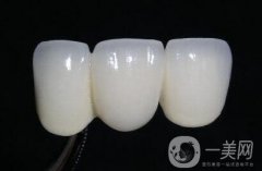 做一個(gè)烤瓷牙套要多少錢?做烤瓷牙要多少錢?