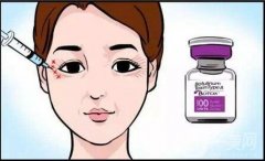 預(yù)防魚(yú)尾紋有哪些方法?去掉魚(yú)尾紋有哪些方法?