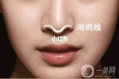 海鷗線和無海鷗線有什么區(qū)別?海鷗線的好處有哪些?