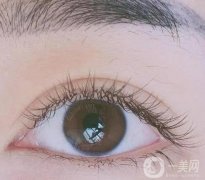 雙眼皮失敗的體現(xiàn)在哪？這七點需要注意！