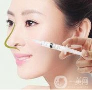 鼻子用玻尿酸有什么危害呢?打玻尿酸鼻子會(huì)腫幾天?