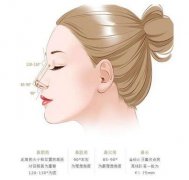 鷹鉤鼻矯正貴嗎?術前準備及術后護理總結