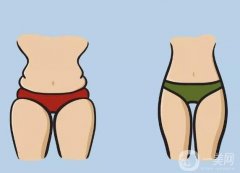 誰不適合腿部吸脂？小腿吸脂需要注意哪些問題？