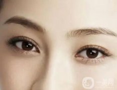 通常哪些人不適合開眼角？疤痕體質不適合開眼角？