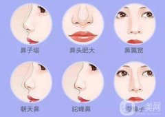 硅膠假體隆鼻多久需要取出?