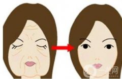 拉皮手術(shù)果怎么樣?費(fèi)用是多少?