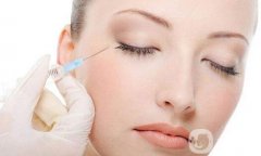 *注射除皺的原理是什么?BOTOX注射除皺美容果好嗎?