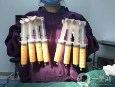 吸脂怎么樣?哪些人適合做?術(shù)后有什么注意事項(xiàng)?