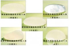 怎么才能讓胸變大?曼托隆胸材料怎么樣?