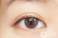 割雙眼皮手術(shù)后的注意事項有哪些?