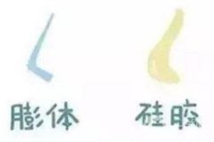 硅膠好和還是膨體好?