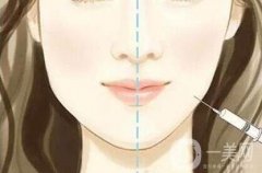 整容有什么副作用:黑臉娃娃、*的副作用