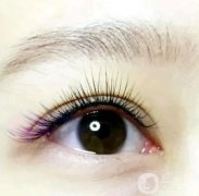 種植睫毛會(huì)不會(huì)很痛？種植睫毛有什么禁忌？