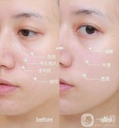 打*有沒有副作用呢，副作用是什么?