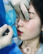 玻尿酸隆鼻可以管多久，玻尿酸隆鼻的風(fēng)險有哪些？