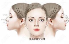 鼻部手術(shù)可以抽煙嗎?可以吃魚嗎?