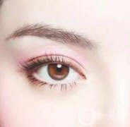 割雙眼皮眼睛腫了應(yīng)該怎么辦，疤克可以預(yù)防疤痕增生嗎