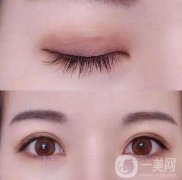 割雙眼皮有啥好處?好處不看不知道!