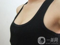 副乳切除術(shù)后需要多久恢復(fù)?