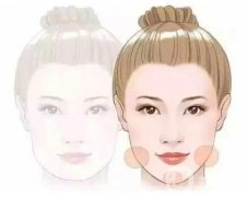 玻尿酸注射下巴后的注意事項(xiàng)是什么?