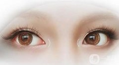 雙眼皮手術(shù)后如何避免留下疤痕？如何修復(fù)雙眼皮失??？