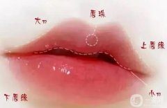 微笑唇手術(shù)后需要多久恢復(fù)？術(shù)后如何幫助恢復(fù)？