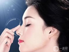 隆鼻手術(shù)時(shí)間是多長(zhǎng)？