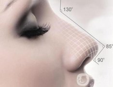 鼻翼內(nèi)切切口在哪里？鼻翼內(nèi)切的原理？
