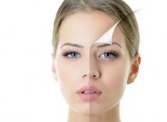 OPT祛斑和超*祛斑的區(qū)別?