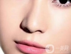 玻尿酸鼻唇溝填充果好嗎?