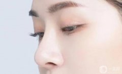 達拉斯隆鼻可以保持多少年？