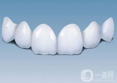 烤瓷牙能用多久?注意事項(xiàng)有哪些?