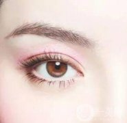 埋線雙眼皮如何快速消腫?