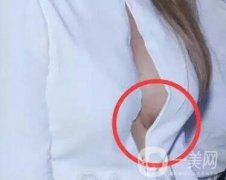 隆胸手術之后都有哪些注意事項?