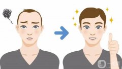 植發(fā)后多長時(shí)間頭發(fā)能長出來？